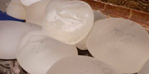 Το σκάνδαλο με τα εμφυτεύματα στήθους στη Γαλλία