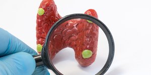 Παθήσεις των παραθυρεοειδών αδένων και χειρουργική αντιμετώπιση