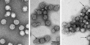 Θεσσαλονίκη: Με ήπια συμπτώματα τα κρούσματα κροτωνογενούς εγκεφαλίτιδας σε ανθρώπους στην Ελλάδα