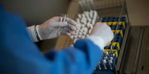 μονοκλωνικά αντισώματα εργαστήριο