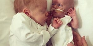 Δίδυμα αδέρφια αγκαλιάζονται