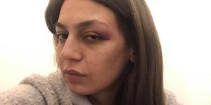 Η βουλευτής του ΜέΡΑ25 Μαρία Απατζίδη