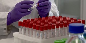 μετάλλαξη Μποτσουάνα, εργαστήριο