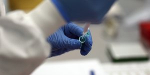 Επιστήμονας σε εργαστήριο για τον κορωνοϊό και τη μετάλλαξη Ομικρον