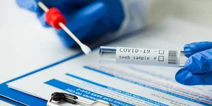 PCR test μοριακός έλεγχος