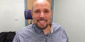 Ο Στιβ Βερζ, στον οποίο τοποθετήθηκε το πρώτο προσθετικό μάτι από 3D εκτυπωτή