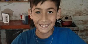 10χρονος με εγκαύματα