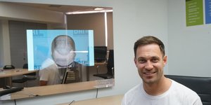 Μεταμόσχευση μαλλιών