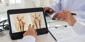 Διακαθετηριακή αντιμετώπιση ανευρυσμάτων