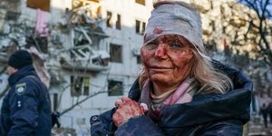 Ουκρανή πολίτης, τραυματισμένη, στο Χάρκοβο