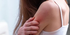 Γυναίκα φαγούρα μπράτσο ψωρίαση