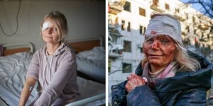 Η Ουκρανή δασκάλα κατάφερε να πάει σε ειδικό οφθαλμολογικό κέντρο στην Πολωνία, όπου χειρουργήθηκε στο μάτι