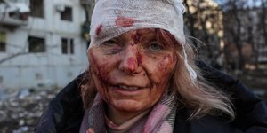 Γυναίκα στο Χάρκοβο τραυματισμένη από ρωσικό βομβαρδισμό