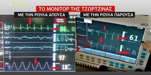 Μόνιτορ Τζωρτζίνας πριν και μετά τη ΜΕΘ