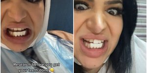 Δόντια που θύμιζαν πλήκτρα πιάνου απέκτησε μια Λονδρέζα 