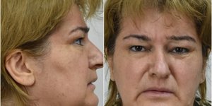 Ληστεία οικιακή βοηθός 48χρονη ηλικιωμένοι