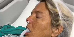 Δόντια Τουρκίας, μια μεγάλη περιπέτεια για μια ακόμη γυναίκα που ήθελε να φτιάξει χαμόγελο