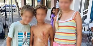 Τα παιδιά που δέχθηκαν επίθεση από αγέλη σκύλων