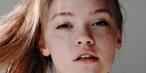 γυναίκα με φακίδες