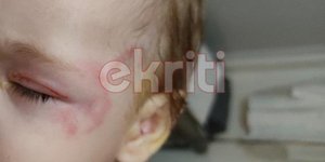 Το μωρό που δέχθηκε επίθεση σκύλου στο Ηράκλειο