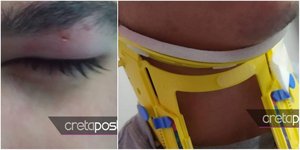 Οδηγός επιτέθηκε σε μαθητές στην Κρήτη