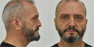 Ο 53χρονος Ηλίας Μίχος