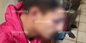 Ο ένας εκ των δύο Ρομά που καταδίωξε η ΕΛ.ΑΣ.