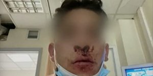 Θεσσαλονίκη ξυλοκόπησαν 20χρονο