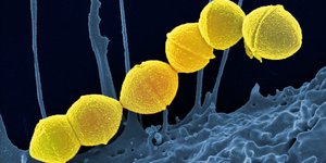 Βακτήρια στρεπτόκοκκου της ομάδας Α