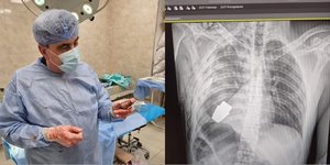 Ο χειρουργός κρατά στα χέρια τη χειροβομβίδα που αφαίρεσε από το θώρακα Ουκρανού στρατιώτη