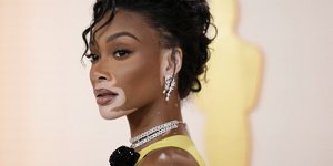 Winnie Harlow