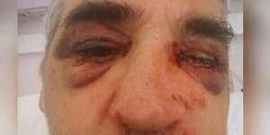 O αρχαιολόγος που ξυλοκοπήθηκε στη Μύκονο
