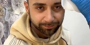 Έκανε τατουάζ - φράντζα για να κρύψει τη φαλάκρα του