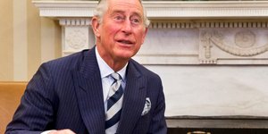 Σάλος από τα πρησμένα και κόκκινα άκρα του βασιλιά Καρόλου 