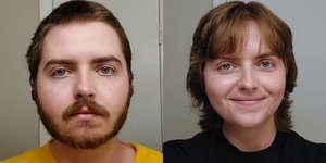 Τρανς μοιράζεται τις αλλαγές στην εμφάνιση μετά από ορμονική θεραπεία