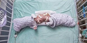 Οι σιαμαίες Άμπι και Έριν Ντελανέι