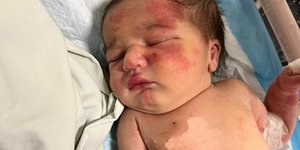 βρέφος μωρό νεογνό Λίβανος Τρίπολη εγκατάλειψη σκυλί