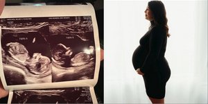 H Κέλσι Χάτσερ, κυοφορεί από ένα μωρό στις δύο μήτρες της