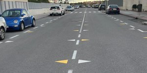 Κίτρινα δόντια