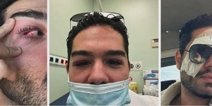 Ο Χρήστος Μάστορας έδειξε το πρόβλημα υγείας που τον έστειλε στο νοσοκομείο