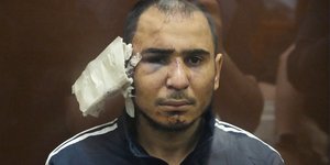 μώλωπες μπανταρισμένο αυτι