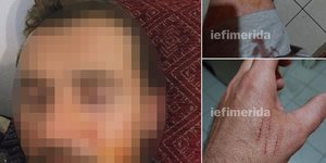 Ο 41χρονος που συνελήφθη μαζί με την εν διαστάσει σύζυγό του