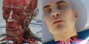 Εταιρεία ισχυρίζεται ότι αναπτύσσει μέθοδο μεταμόσχευσης κεφαλιού