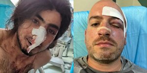 Οι δύο εθελοντές, θύματα της επίθεσης στην Πάρνηθα