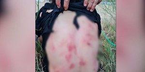 Το σώμα της 44χρονης μετά την επίθεση από τα σκυλιά