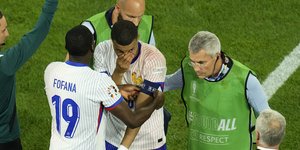 Υπέστη κάταγμα στη μύτη στο ματς με Αυστρία ο Εμπαπέ