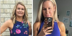 Απίστευτη μεταμόρφωση: Πώς μια 44χρονη μητέρα έχασε λίπος στα πόδια -Τα 2 μυστικά της