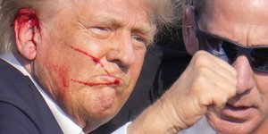 Ο Ρεπουμπλικανός πρώην πρόεδρος των ΗΠΑ, Ντόναλντ Τραμπ με αίματα στο πρόσωπο μετά την απόπειρα δολοφονίας του