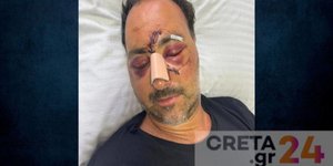 Ο 49χρονος Ελληνοκαναδός που υπέστη τον άγριο ξυλοδαρμό