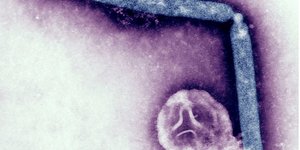 Γρίπη των πτηνών